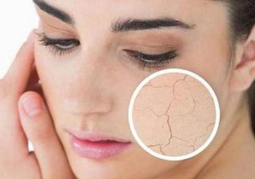 脸上起皮怎么办 5个方法快速消除