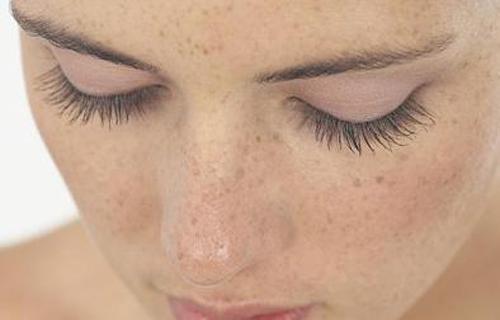 长黄褐斑的原因是什么 长黄褐斑怎么调理