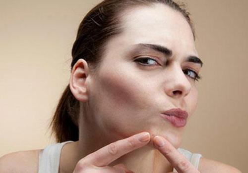 下巴长痘痘是上火吗 下巴长痘痘是什么原因