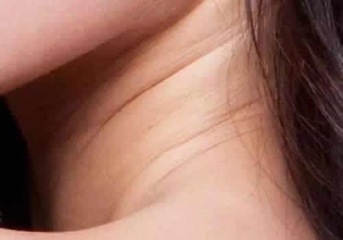 怀孕颈纹加深会消退吗 不想让颈纹暴露你的年龄就来看看