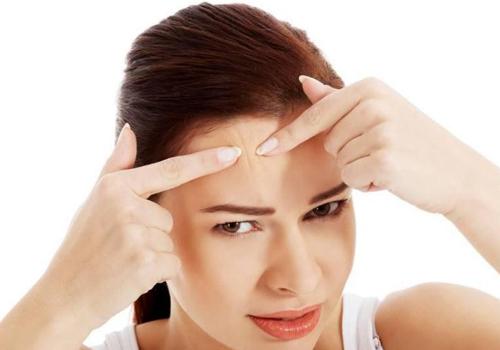 额头长痘痘怎么去除 教你怎样快速祛痘