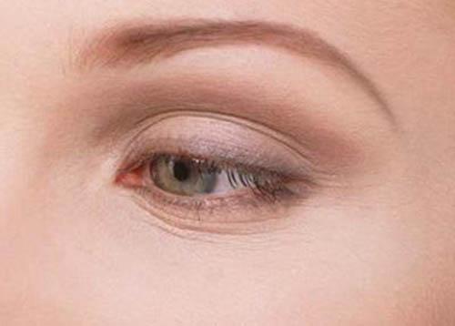 鱼尾纹怎么去除 有鱼尾纹怎么办