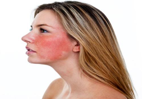 敏感性皮肤的特征 敏感性皮肤的特征、产生原因、修复方法，一应俱全！