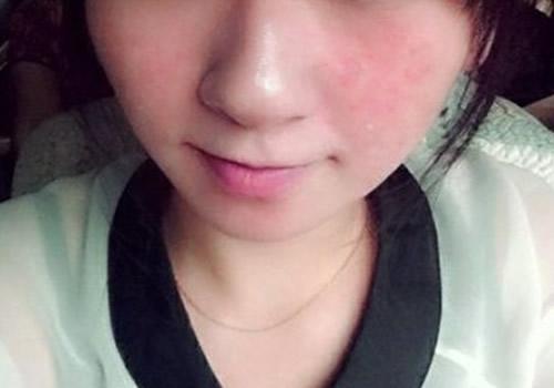 为什么用洗面奶洗完脸通红 用完洗面奶后脸通红怎么办