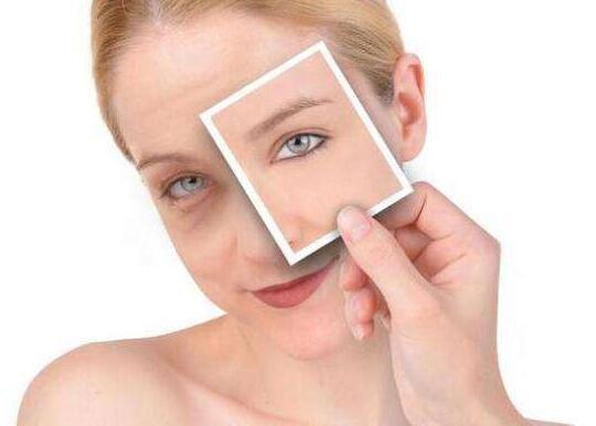 黑眼圈怎么消除 类型不同解决方法也大不同！