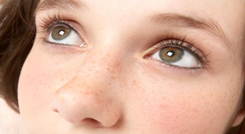 蝴蝶斑会自己消失吗