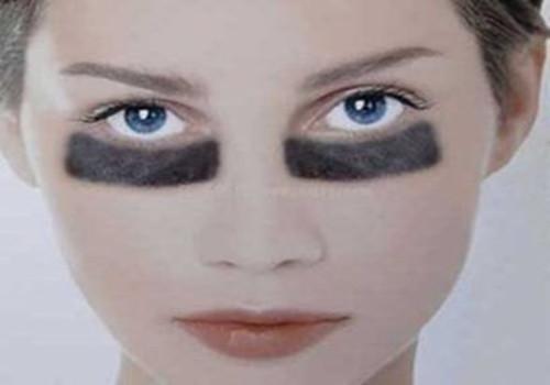 激光去黑眼圈会反弹吗