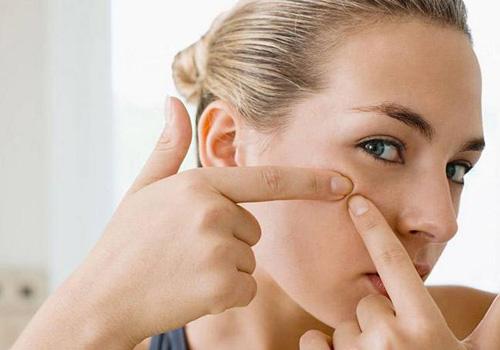 祛痘需要注意哪些问题 不懂不要乱挤