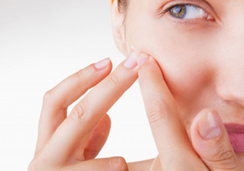 脸上痘印怎么快速去掉 6个小妙招让你轻松祛除痘印