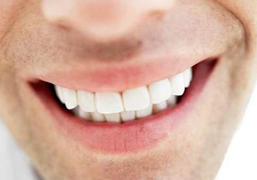 烤瓷牙有缝隙怎么办