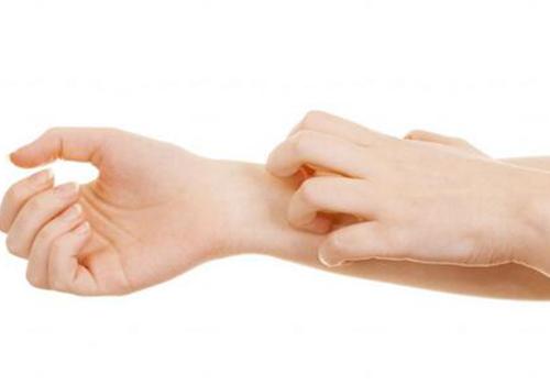 全身痒有什么偏方吗 不要等到奇痒无比的时候再来看