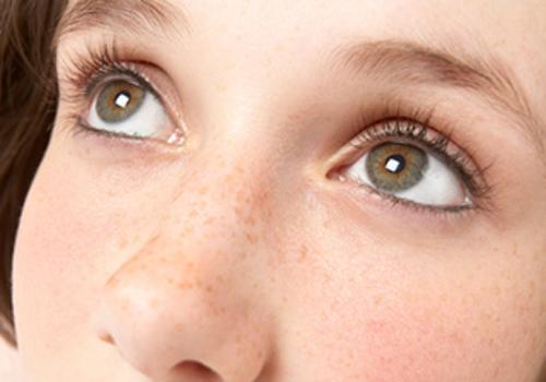 黄褐斑能洗掉吗 脸上黄褐斑怎么洗掉