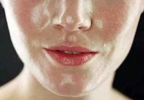 皮肤出油的原因 4点导致你油光满面