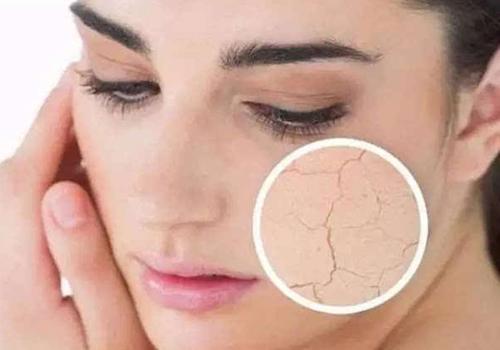 皮肤粗糙是什么原因 皮肤越来越粗糙怎么办