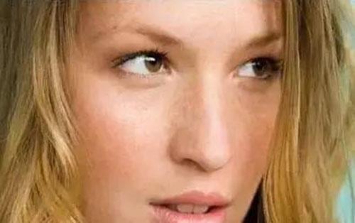 脸上长斑是什么原因 脸上有斑怎么办