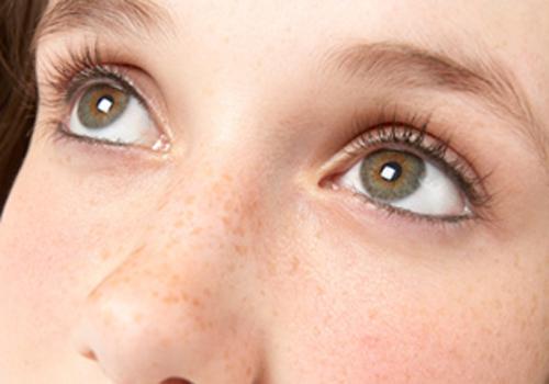 如何去除脸上的黄褐斑 最有效的祛斑小妙招