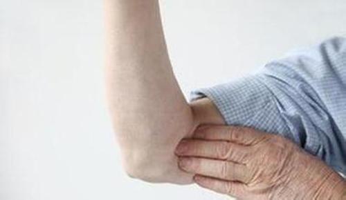 老年人皮肤瘙痒怎么办 7个方面你要注意