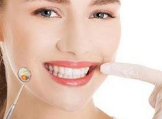 牙齿变黄的原因 牙齿变黄成因多！冷光美白不是什么情况都适合