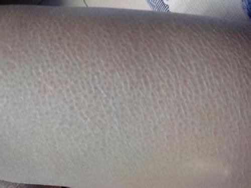 冬天皮肤像蛇皮 对抗干燥瘙痒有妙招