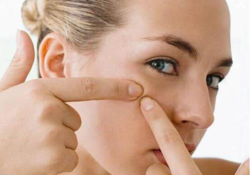 脸颊两侧长痘痘是什么原因 这7大原因必须知道