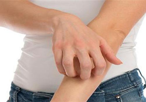 皮肤过敏红肿怎么办 6招帮你护理