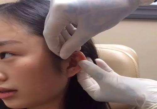 夏天打耳洞好吗 什么季节适合打耳洞