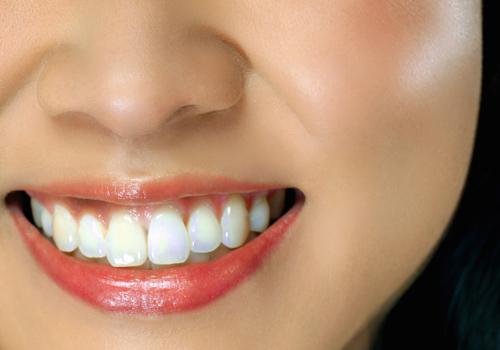 烤瓷牙要做多长时间