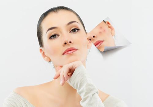 长痘痘是什么原因 皮肤长痘痘怎么办