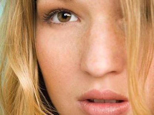 女人长斑是什么原因引起的 正确祛斑还你白嫩肌肤