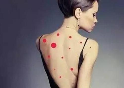 后背长痘痘怎么去除 7个小妙招帮你解决