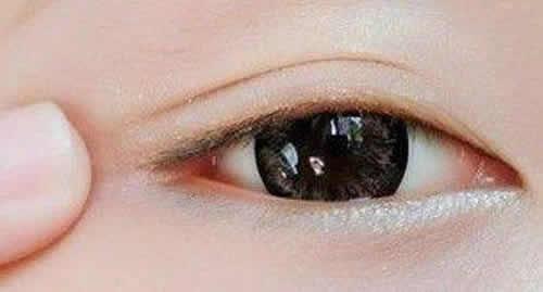 热毛巾敷眼睛消肿吗