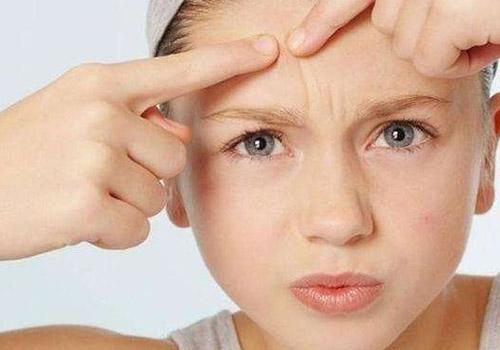 红色痘印怎么消除 给你5个小妙招