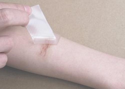 疤痕痒是什么原因 疤痕痒注意事项