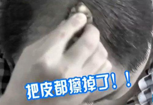 姜汤洗头发有什么好处