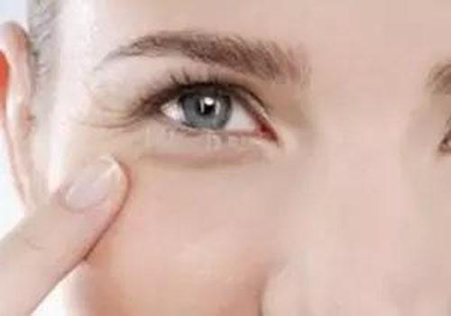 眼角皱纹怎么去除 7种方法简单又实用