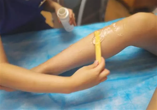 脱腿毛能永久吗 怎么样能永久脱腿毛