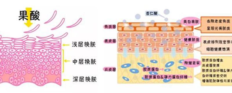 刷酸长痘了还能继续吗 刷酸长痘要不要挤