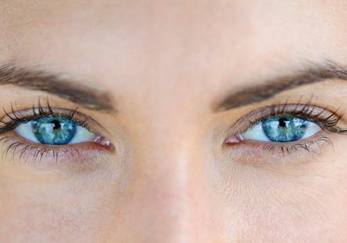 黑眼圈可以消除吗 怎么去黑眼圈比较好