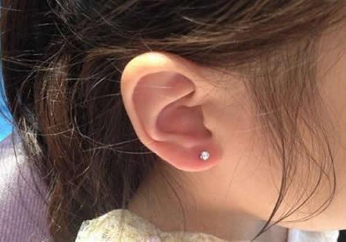 打耳洞容易发炎吗,打耳洞容易发炎怎么办