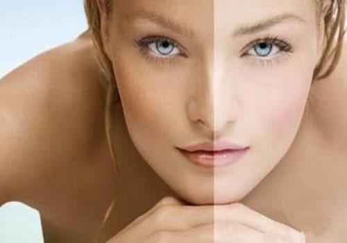 皮肤变黑的原因是什么 怎么让皮肤变白