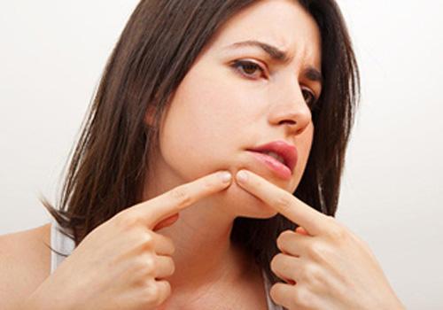 下巴反复长痘痘是什么原因 如何快速去除痘痘