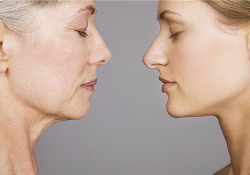 皮肤松弛是什么原因 皮肤松弛怎么办