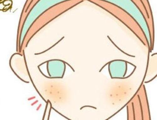 青春痘是怎么引起的 引发青春痘的原因