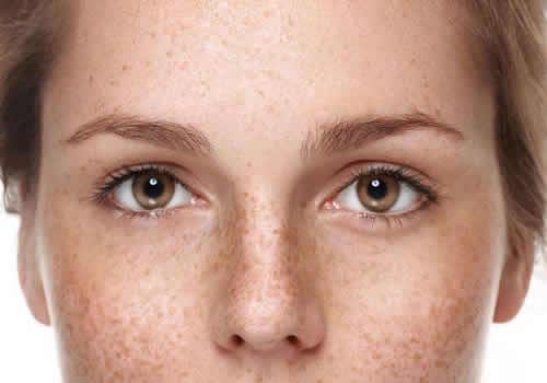 天天用隔离霜会长斑吗 错误使用隔离霜小心变“麻子脸”！