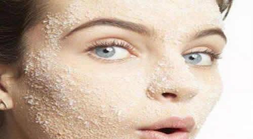 闭口粉刺能用去角质么