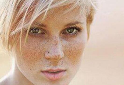 脸上长斑是什么原因
