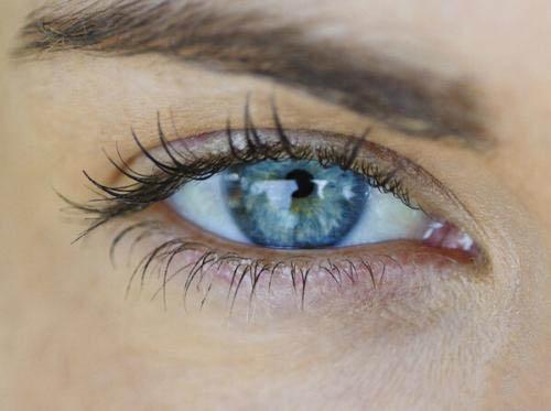 黑眼圈怎么才能消除 黑眼圈的类型