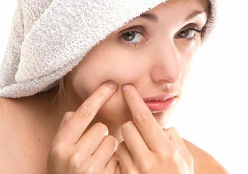 长了闭口粉刺怎么办 千万记住不能挤