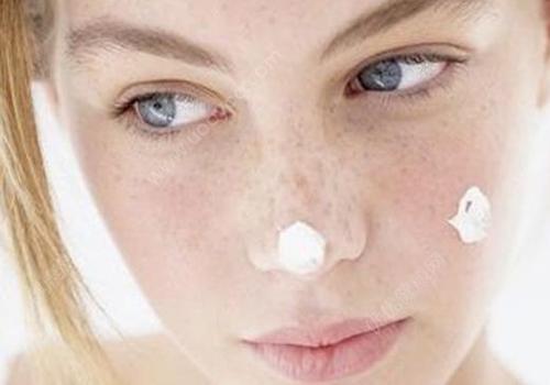 脸上有斑怎么办 6方法帮你消除脸部斑点