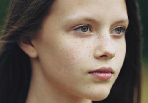 色斑形成的原因是什么 如何淡化色斑